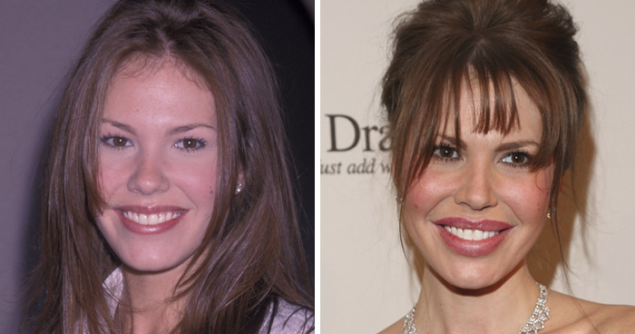20 Celebrities Who Learned The Hard Way About Plastic Surgery