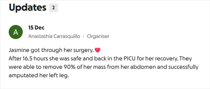 14YO Girl With Rare Condition Undergoes 17 Hours Of Grueling Surgery To Remove 174lb Leg