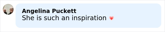 14YO Girl With Rare Condition Undergoes 17 Hours Of Grueling Surgery To Remove 174lb Leg