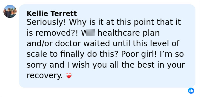 14YO Girl With Rare Condition Undergoes 17 Hours Of Grueling Surgery To Remove 174lb Leg