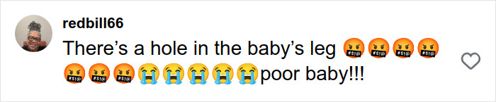 Pit Bull Attacks Toddler On Packed Manhattan Street, Refuses To Release Grip