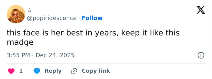 “They Really Photoshopped Her”: Madonna’s Holiday Lingerie Photoshoot Sparks Frenzy