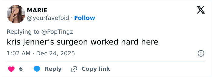 “They Really Photoshopped Her”: Madonna’s Holiday Lingerie Photoshoot Sparks Frenzy