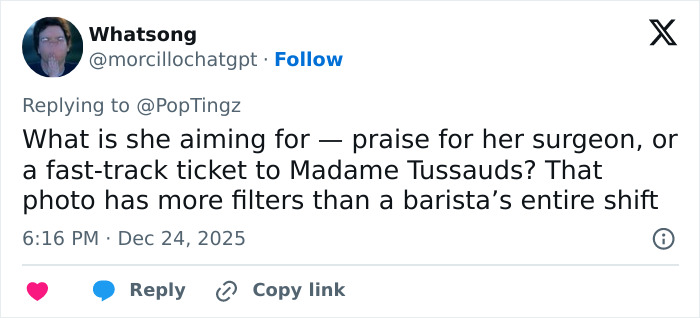 “They Really Photoshopped Her”: Madonna’s Holiday Lingerie Photoshoot Sparks Frenzy