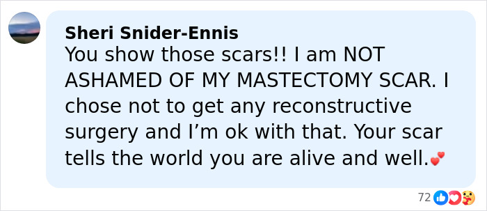 Angelina Jolie Claps Back At ‘Vile’ Trolls Who Targeted Her For Revealing Mastectomy Scars