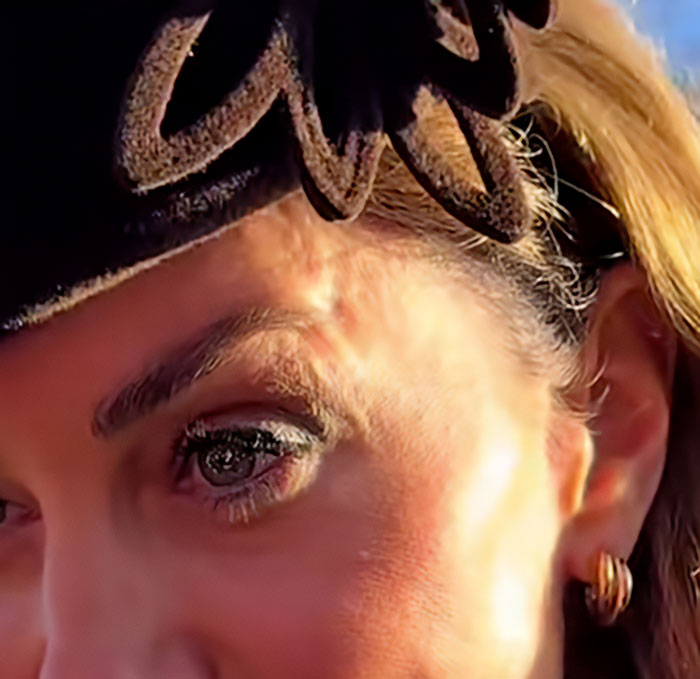 “Never Had Cancer”: Video Of Kate Middleton’s “Scar” During Christmas Appearance Sparks Wild Conspiracy Theories