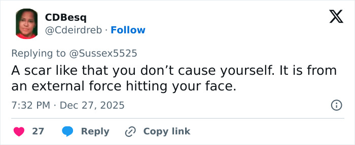 “Never Had Cancer”: Video Of Kate Middleton’s “Scar” During Christmas Appearance Sparks Wild Conspiracy Theories