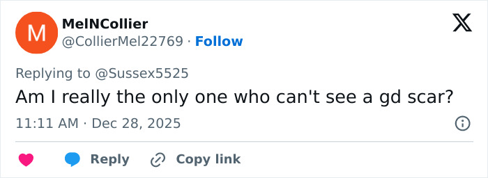 “Never Had Cancer”: Video Of Kate Middleton’s “Scar” During Christmas Appearance Sparks Wild Conspiracy Theories