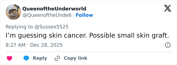 “Never Had Cancer”: Video Of Kate Middleton’s “Scar” During Christmas Appearance Sparks Wild Conspiracy Theories