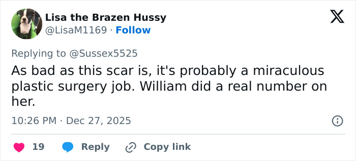 “Never Had Cancer”: Video Of Kate Middleton’s “Scar” During Christmas Appearance Sparks Wild Conspiracy Theories