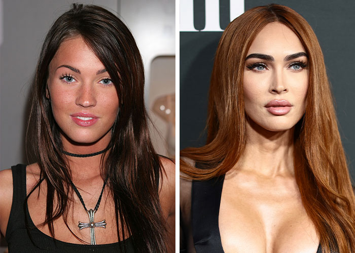 “What Happened To All The Faces?”: Woman Sparks Debate Over Hollywood Actresses Starting To Look Identical