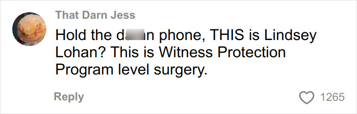 “What Happened To All The Faces?”: Woman Sparks Debate Over Hollywood Actresses Starting To Look Identical