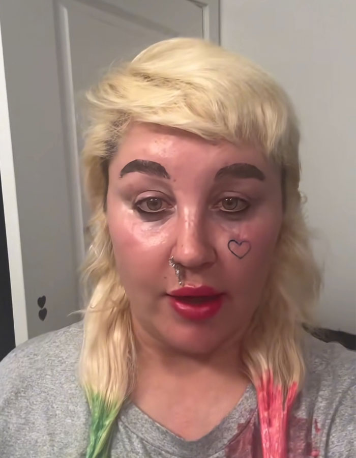 Amanda Bynes Opens Up About Using Injections After Paparazzi Pic Shows Dramatic Weight Loss Amanda Bynes Opens Up About Using Injections After Paparazzi Pic Shows Dramatic Weight Loss