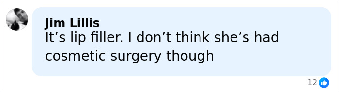 Millie Bobby Brown’s Sad Confession About Plastic Surgery Rumors On Vogue Issue Stuns Millie Bobby Brown’s Sad Confession About Plastic Surgery Rumors On Vogue Issue Stuns