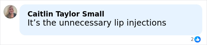 Millie Bobby Brown’s Sad Confession About Plastic Surgery Rumors On Vogue Issue Stuns Millie Bobby Brown’s Sad Confession About Plastic Surgery Rumors On Vogue Issue Stuns