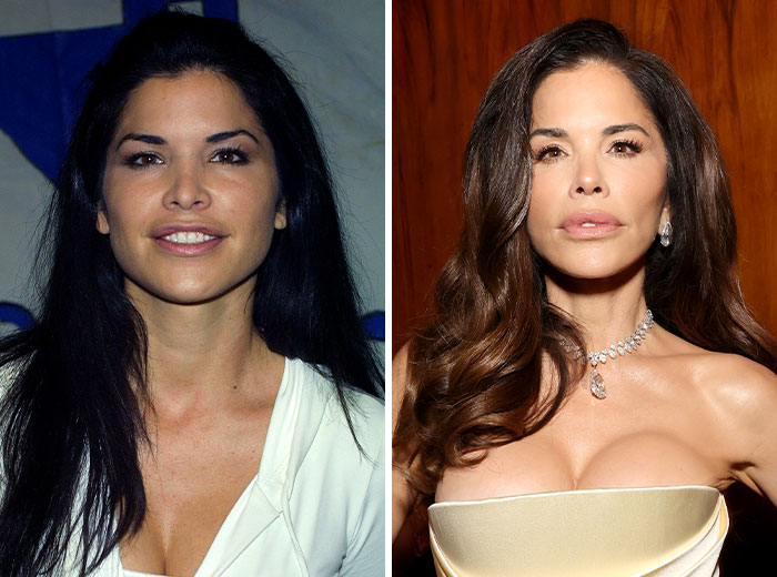 10 “Mar-a-Lago” Face Transformations That Left People Utterly Stunned 10 “Mar-a-Lago” Face Transformations That Left People Utterly Stunned