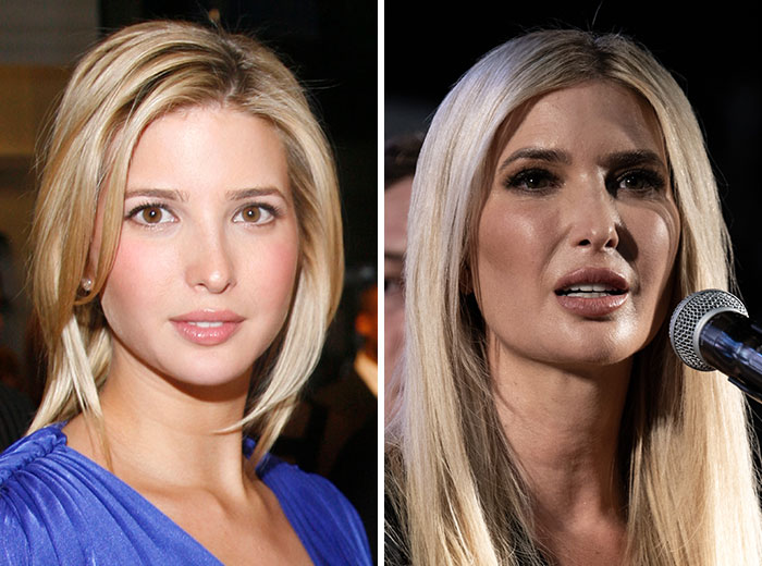 10 “Mar-a-Lago” Face Transformations That Left People Utterly Stunned 10 “Mar-a-Lago” Face Transformations That Left People Utterly Stunned