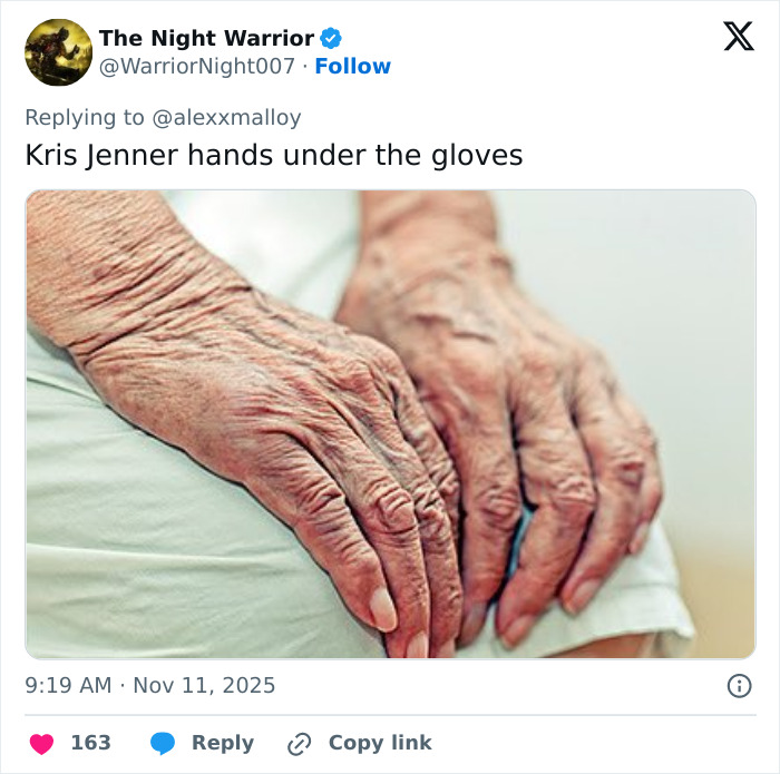 “The Hands Never Lie”: Kris Jenner Finally Ditches Gloves In Public After Viral $100k Facelift “The Hands Never Lie”: Kris Jenner Finally Ditches Gloves In Public After Viral $100k Facelift