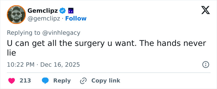 “The Hands Never Lie”: Kris Jenner Finally Ditches Gloves In Public After Viral $100k Facelift “The Hands Never Lie”: Kris Jenner Finally Ditches Gloves In Public After Viral $100k Facelift