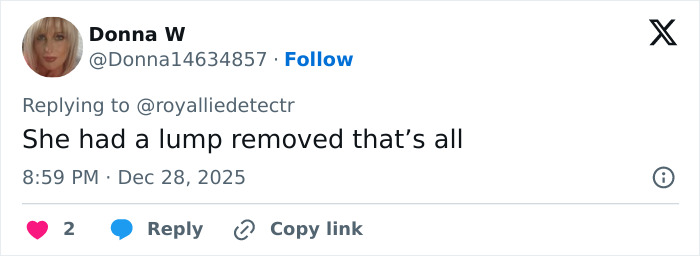 Kate Middleton’s Facial Scar Fuels Rumors Her 2024 Hospitalization Was More Serious Than Claimed Kate Middleton’s Facial Scar Fuels Rumors Her 2024 Hospitalization Was More Serious Than Claimed