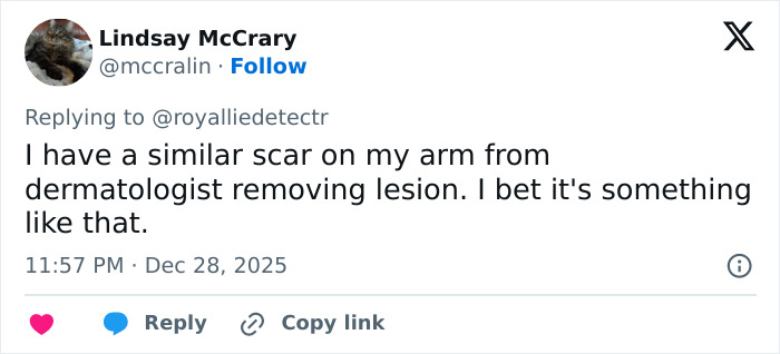 Kate Middleton’s Facial Scar Fuels Rumors Her 2024 Hospitalization Was More Serious Than Claimed Kate Middleton’s Facial Scar Fuels Rumors Her 2024 Hospitalization Was More Serious Than Claimed