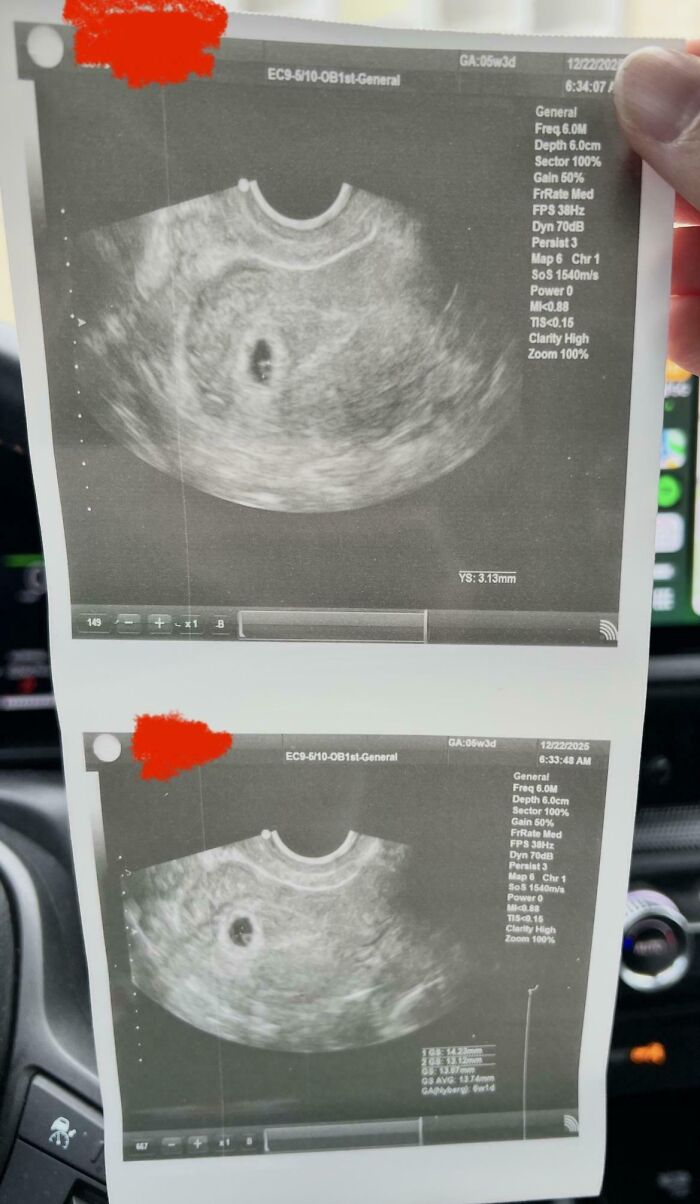 52 Holiday Moments So Sweet They Could Melt Even The Grinchiest Heart (New Pics) 52 Holiday Moments So Sweet They Could Melt Even The Grinchiest Heart (New Pics)