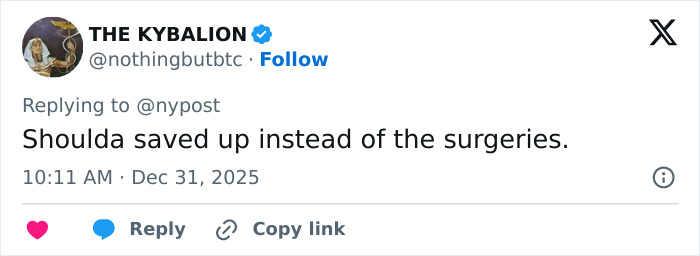 “9 1/2 Weeks To Vacate”: Unrecognizable Mickey Rourke Faces Eviction From LA Home Over $60K Unpaid Rent