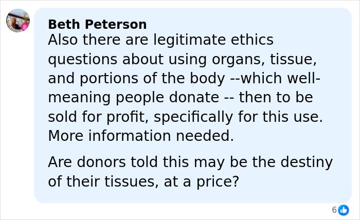 Why Donated Lifeless Bodies Are Being Used For BBLs And Breast Implants Now Why Donated Lifeless Bodies Are Being Used For BBLs And Breast Implants Now