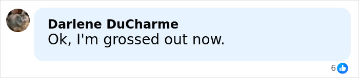 Why Donated Lifeless Bodies Are Being Used For BBLs And Breast Implants Now Why Donated Lifeless Bodies Are Being Used For BBLs And Breast Implants Now
