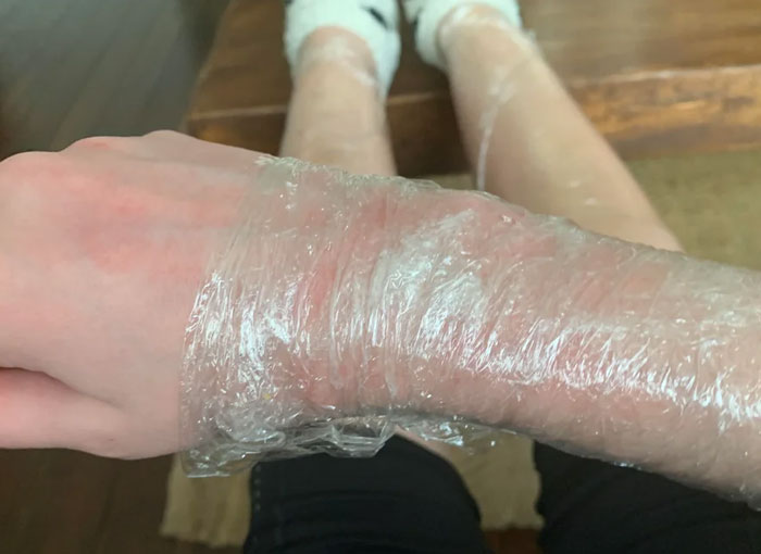 57 Crazy Things Teens Did To Fit Beauty Standards That Everyone Thought Were Normal