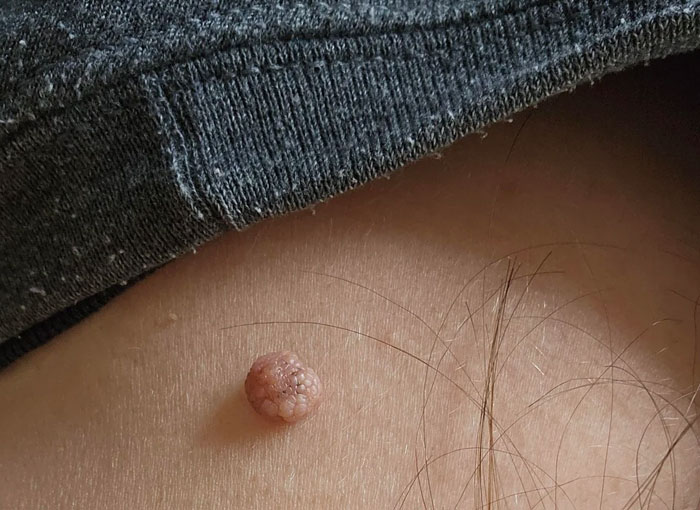 57 Crazy Things Teens Did To Fit Beauty Standards That Everyone Thought Were Normal