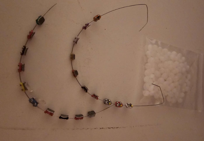 57 Crazy Things Teens Did To Fit Beauty Standards That Everyone Thought Were Normal