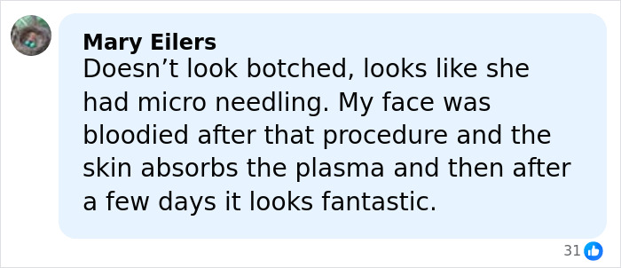 “Really Disturbing”: SNL Star Reveals “Botched” Cosmetic Procedures In Concerning Photos “Really Disturbing”: SNL Star Reveals “Botched” Cosmetic Procedures In Concerning Photos