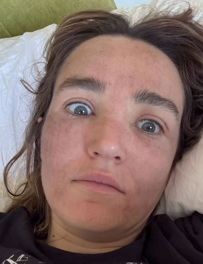 “Really Disturbing”: SNL Star Reveals “Botched” Cosmetic Procedures In Concerning Photos “Really Disturbing”: SNL Star Reveals “Botched” Cosmetic Procedures In Concerning Photos