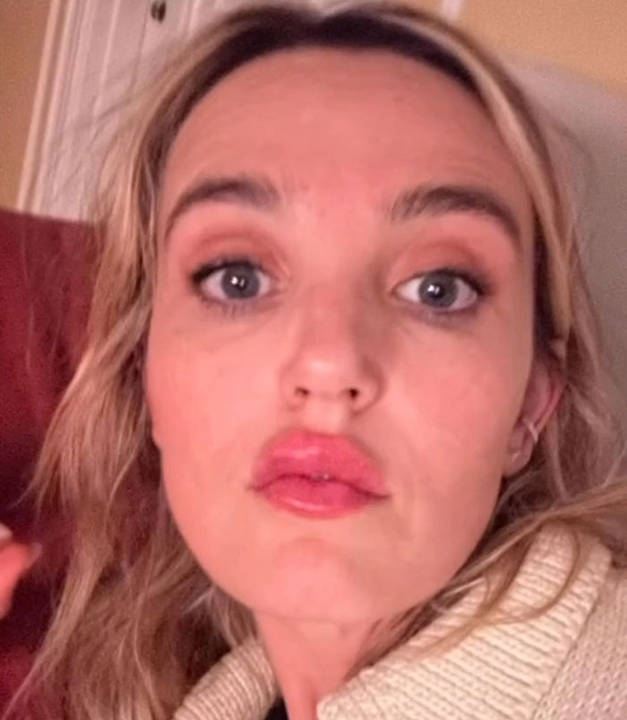 “Really Disturbing”: SNL Star Reveals “Botched” Cosmetic Procedures In Concerning Photos “Really Disturbing”: SNL Star Reveals “Botched” Cosmetic Procedures In Concerning Photos