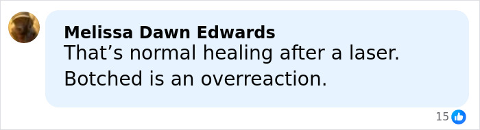“Really Disturbing”: SNL Star Reveals “Botched” Cosmetic Procedures In Concerning Photos “Really Disturbing”: SNL Star Reveals “Botched” Cosmetic Procedures In Concerning Photos