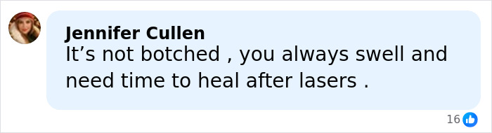 “Really Disturbing”: SNL Star Reveals “Botched” Cosmetic Procedures In Concerning Photos “Really Disturbing”: SNL Star Reveals “Botched” Cosmetic Procedures In Concerning Photos