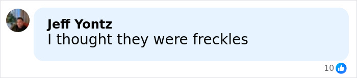 “Really Disturbing”: SNL Star Reveals “Botched” Cosmetic Procedures In Concerning Photos “Really Disturbing”: SNL Star Reveals “Botched” Cosmetic Procedures In Concerning Photos