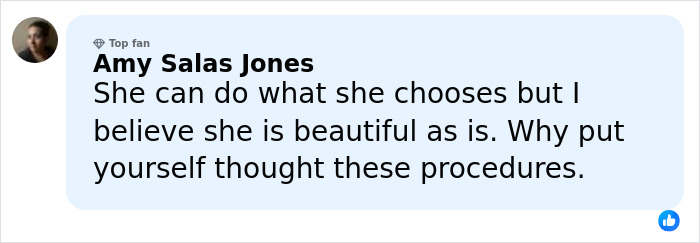 “Really Disturbing”: SNL Star Reveals “Botched” Cosmetic Procedures In Concerning Photos “Really Disturbing”: SNL Star Reveals “Botched” Cosmetic Procedures In Concerning Photos