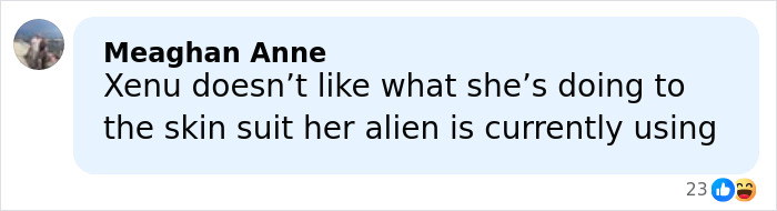 “Really Disturbing”: SNL Star Reveals “Botched” Cosmetic Procedures In Concerning Photos “Really Disturbing”: SNL Star Reveals “Botched” Cosmetic Procedures In Concerning Photos