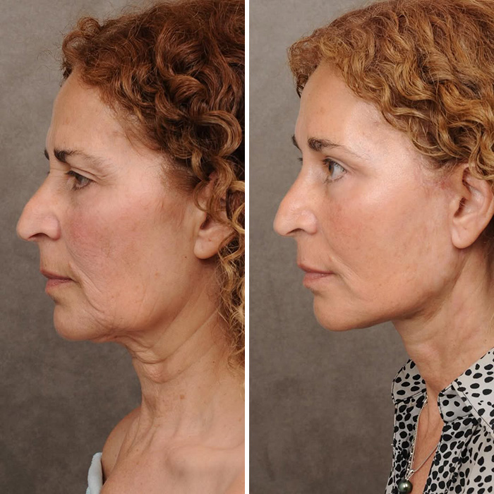 Plastic Surgeon’s Blunt Response To Criticism On Before-And-After Reveal Goes Viral