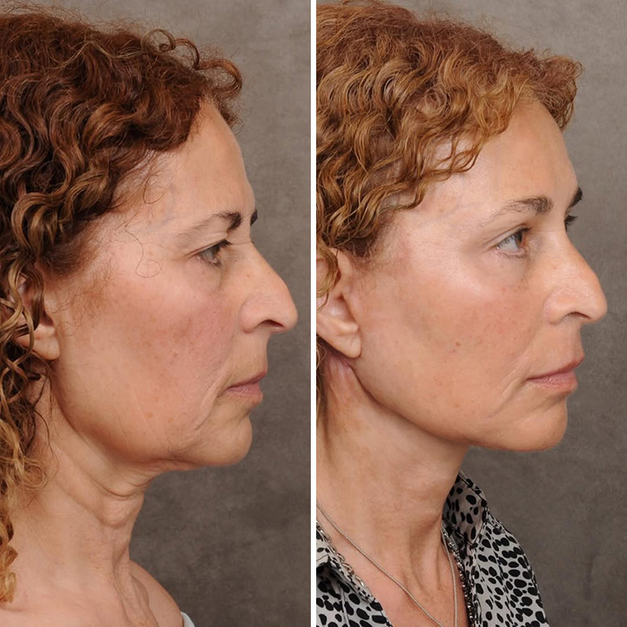 Plastic Surgeon’s Blunt Response To Criticism On Before-And-After Reveal Goes Viral