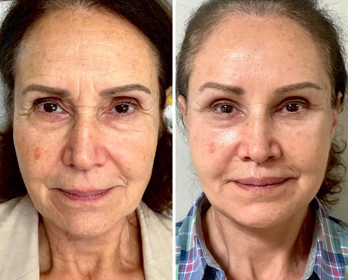 Plastic Surgeon’s Blunt Response To Criticism On Before-And-After Reveal Goes Viral