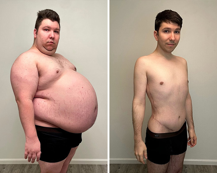 Plastic Surgeon’s Blunt Response To Criticism On Before-And-After Reveal Goes Viral