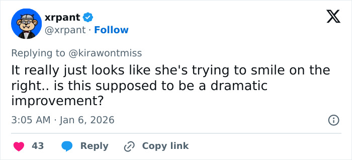 Plastic Surgeon’s Blunt Response To Criticism On Before-And-After Reveal Goes Viral