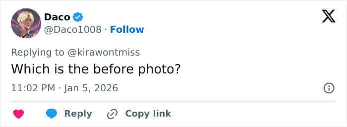 Plastic Surgeon’s Blunt Response To Criticism On Before-And-After Reveal Goes Viral