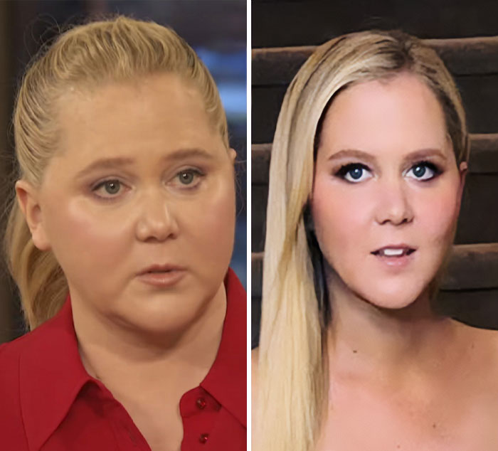 Amy Schumer’s Bikini Shots Stun After Major Weight Loss Transformation