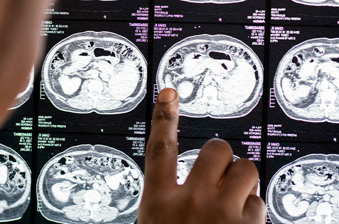 &ldquo;Saw Images On Google And I&rsquo;m Forever Traumatized&rdquo;: 48 Facts People Regret Knowing