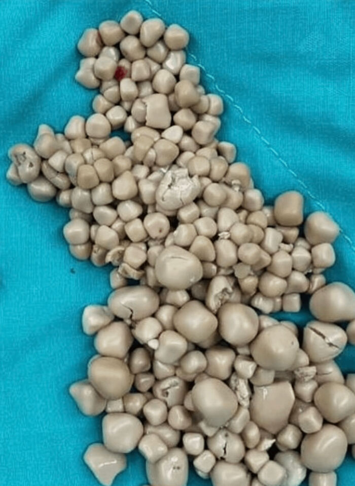 57 Fascinating And Unnerving Medical Pics You May Need A Minute To Process (New Pics)