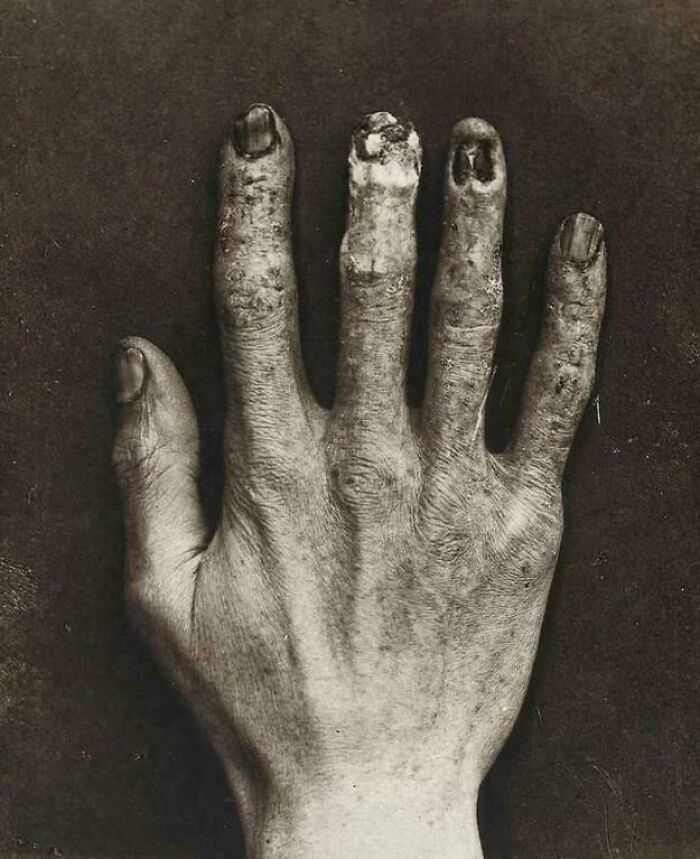 57 Fascinating And Unnerving Medical Pics You May Need A Minute To Process (New Pics)